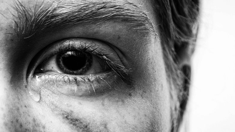 BCC-#10---Tear-Duct-Obstruction_-Symptoms,-Risks,-and-How-to-Treat-It