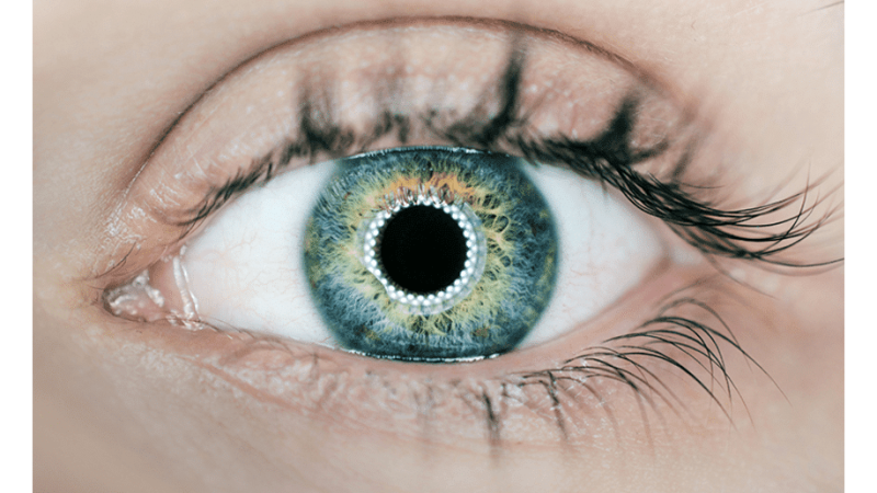 Can-LASIK-Treat-Astigmatism